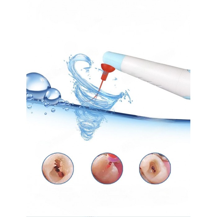 Насадки для эндоактиватора 25/04 30шт