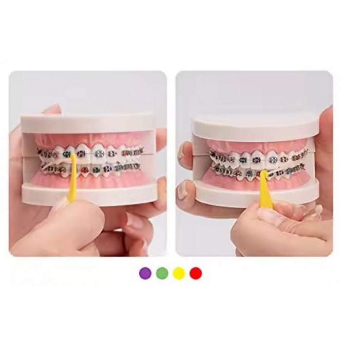 Гачки-плейсери для ортодонтичних еластиків, 10шт