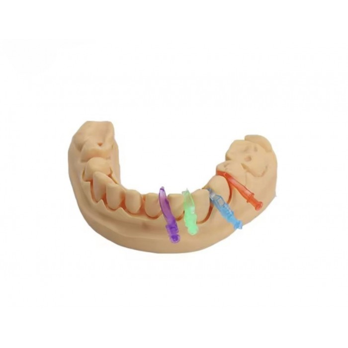Набір стоматологічних матричних клинів 210 шт