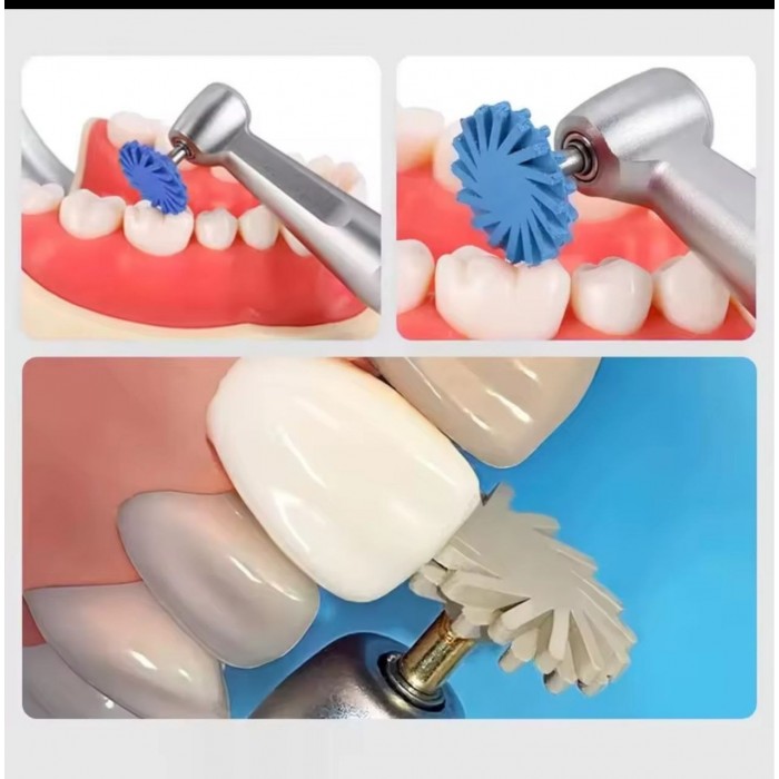 Стоматологические резиновые полировочные диски, набор 6 шт (Coarse / Medium / Fine)